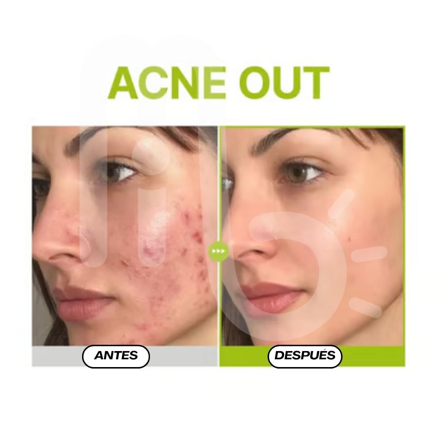 Azelaic Acid 10 Kojic Azulene Serum 30ml - Purito (2)